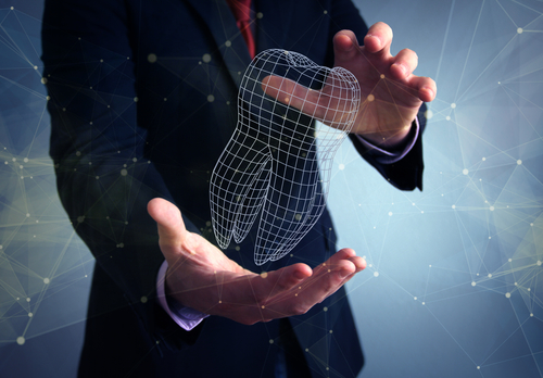 implant dental design